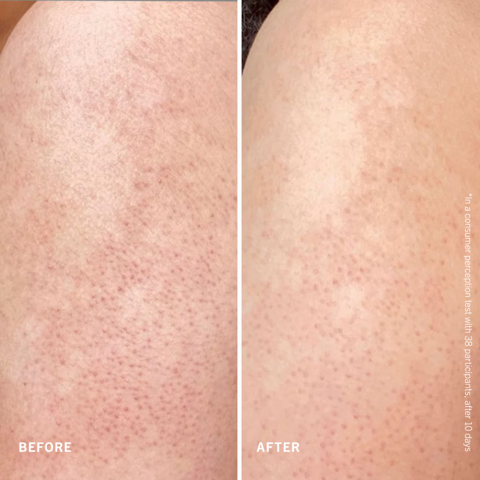 First Aid Beauty Smooth + Juicy Scrub Kit