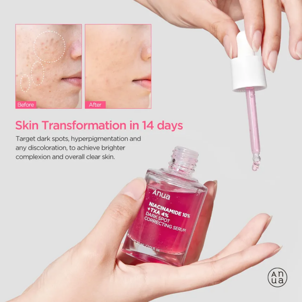Anua 10% Niacinamide + 4% TXA Serum 30 ml