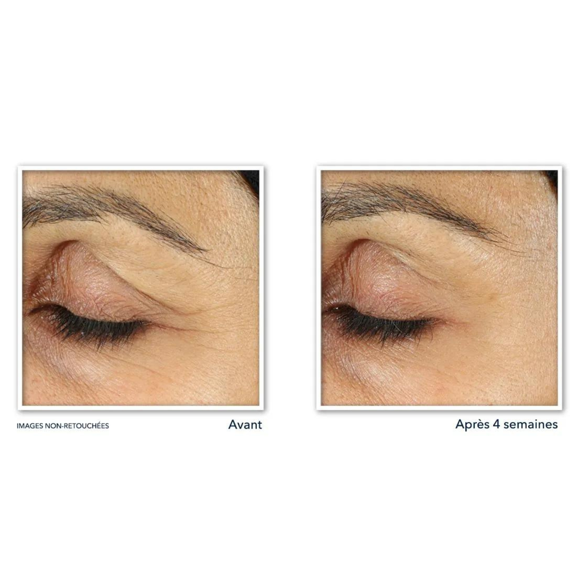 ROC RETINOL CORREXION® Soin Lissant Crème Yeux - 15ml