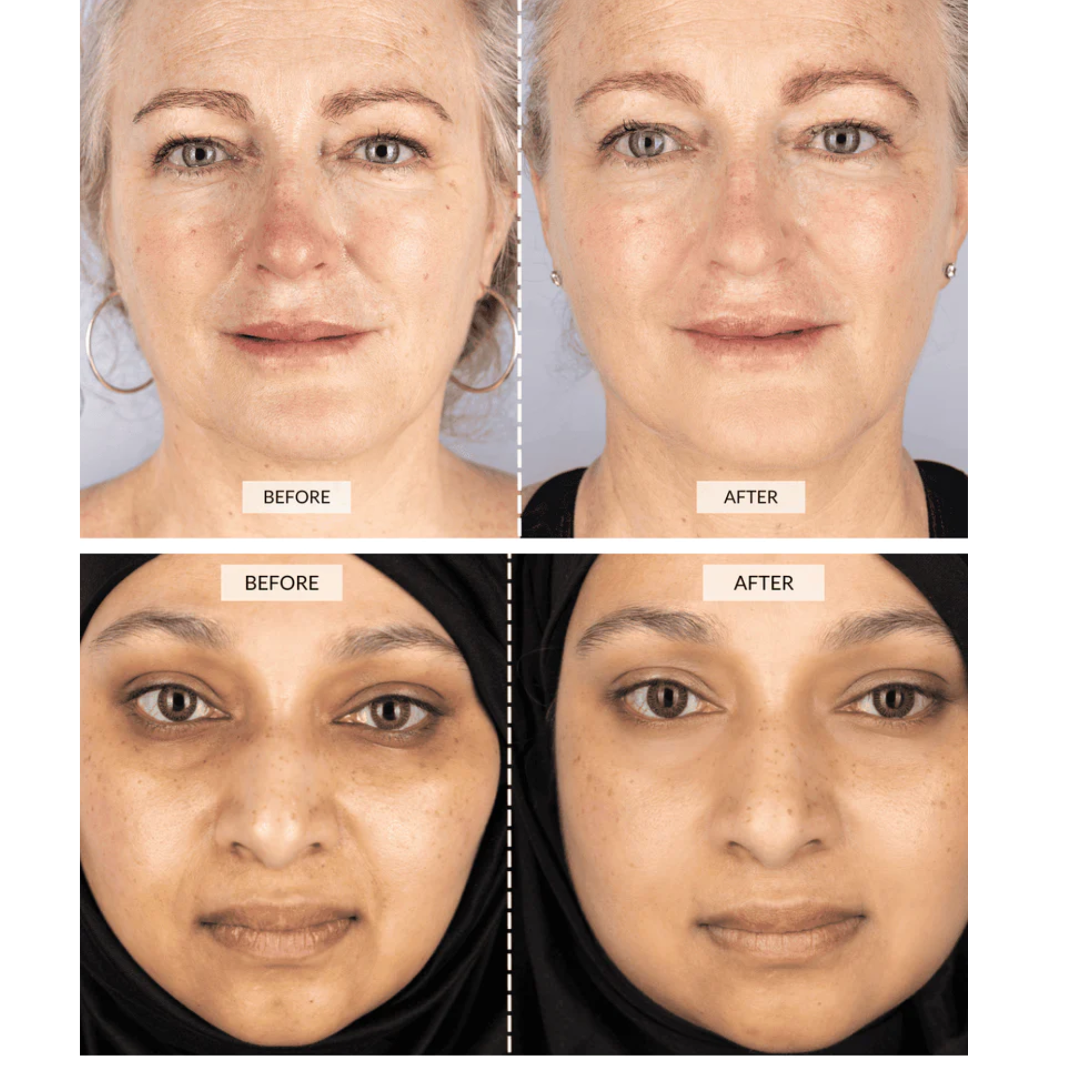 CurrentBody Skin LED Light Therapy Face Mask