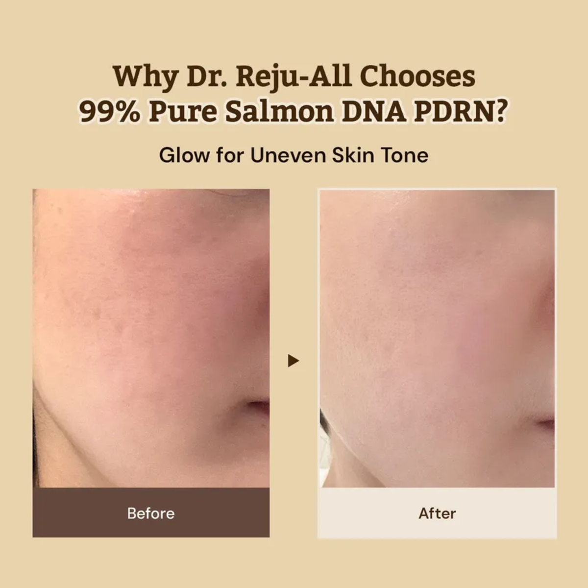 Dr. Reju-All Advanced PDRN Rejuvenating Cream