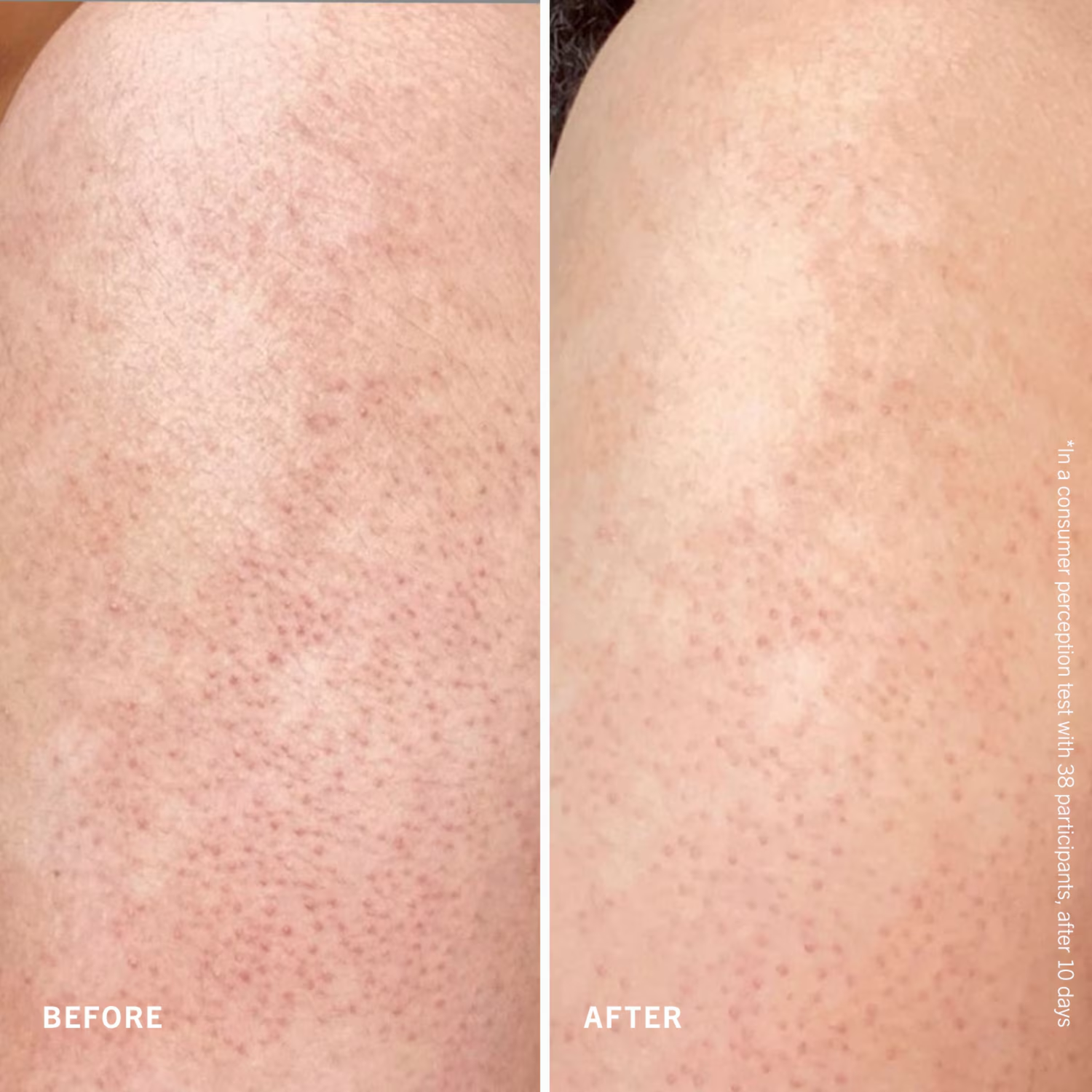 First Aid Beauty Smooth + Juicy Scrub Kit