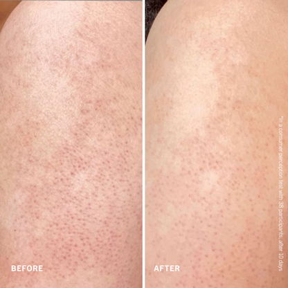 First Aid Beauty Smooth + Juicy Scrub Kit