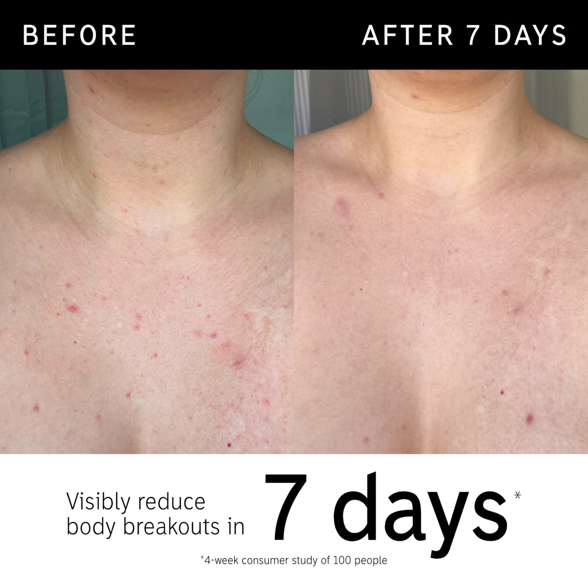 The INKEY List Glycolic Acid Body Exfoliating Stick