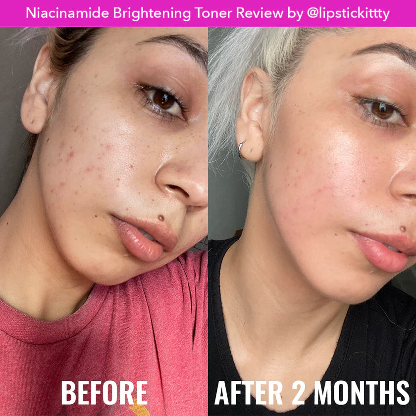 NIACINAMIDE BRIGHTENING TONER 120 ML