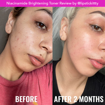NIACINAMIDE BRIGHTENING TONER 120 ML